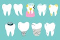 ÃÂ¡ollection of white teeth in various states